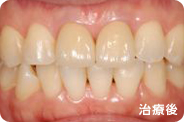 caries_case_01_after